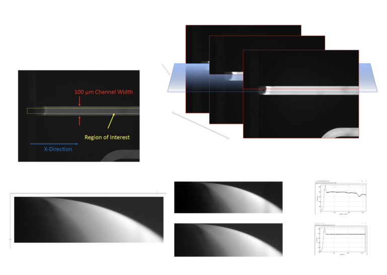 steps in image processing